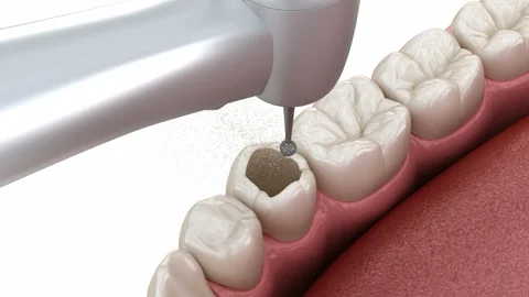 qdental