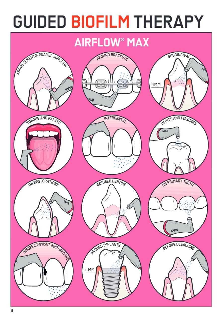 qdental