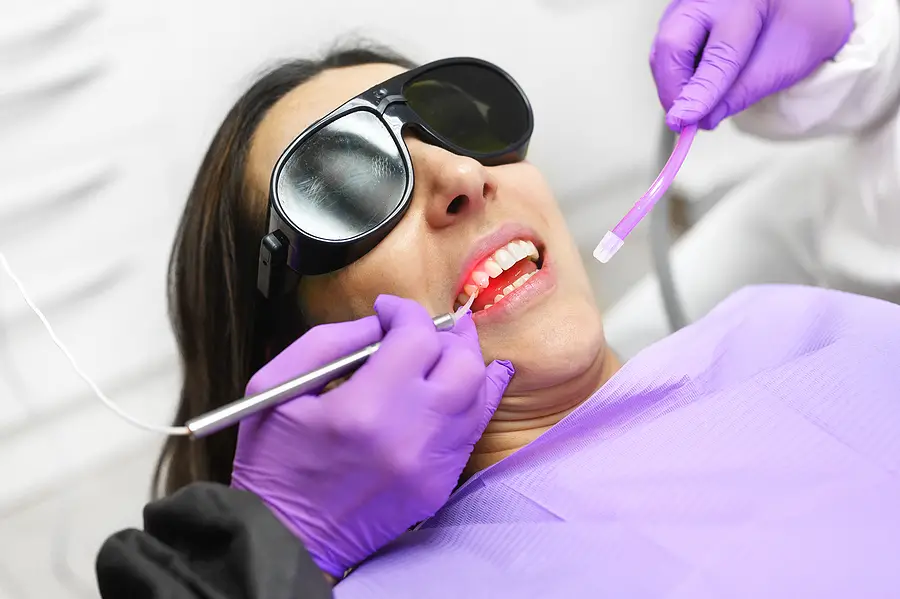 Full mouth implants